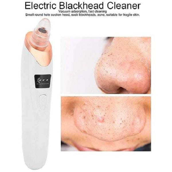 Blackhead Remover Machine Vacuum Acne Cleaner 5 In 1 Spots Removal Device